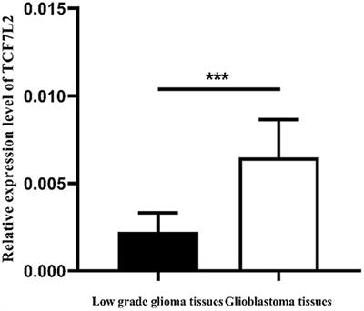 Expression of TCF7L2 in Glioma and Its Relationship With Clinicopathological Characteristics and Patient Overall Survival